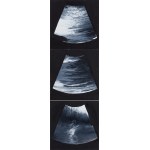 Rafał Bujnowski (b. 1974, Wadowice), Untitled (triptych), 2005