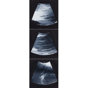Rafał Bujnowski (b. 1974, Wadowice), Untitled (triptych), 2005