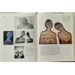 Salvador DALI (1904–1989), Couple with Heads Full of Clouds (Couple aux têtes pleines de nuages), ca. 1980
