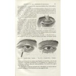 GAŁĘZOWSKI, Ksawery - Traité des maladies des yeux / par X. Galezowski. 2...