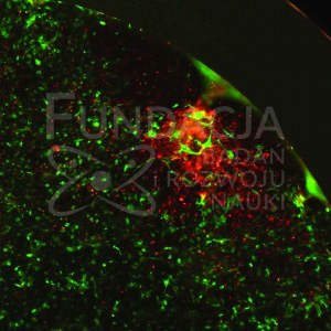Fundacja Badań i Rozwoju Nauki, Hodowla komórek śródbłonka i fibroblastów