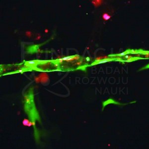Fundacja Badań i Rozwoju Nauki, Łączenie komórek śródbłonka i fibroblastów