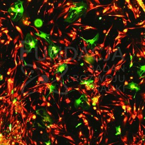 Fundacja Badań i Rozwoju Nauki, Porządkowanie się komórek śródbłonka i fibroblastów