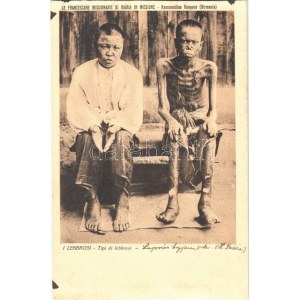 Kyimyindaing, Kemmendine Rangoon (Burma, Birmania), Le Francescane Missionarie di Maria in MIssione, I Lebrosi...