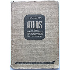 TIODALGINA. ATLAS 25 tablic przedstawiających technikę wstrzykiwań miejscowych...