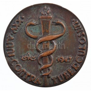 Csúcs Ferenc (1905-1999) 1947. Dr. Korányi Sándor 1923-1948 / XXV. Anni.Contra Tuberculosim kétoldalas bronz plakett...