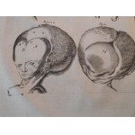 1686. BONET Théophile, Medicina septentrionalis collatitia, sive rei medicæ, nuperis annis a medicis Anglis, Germanis &amp; Danis emissae, sylloge &amp; syntaxis (...).