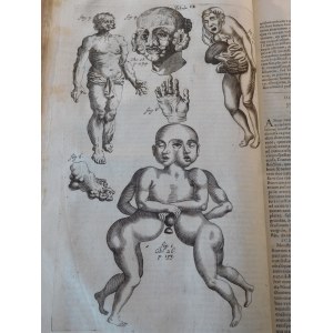 1686. BONET Théophile, Medicina septentrionalis collatitia, sive rei medicæ, nuperis annis a medicis Anglis, Germanis & Danis emissae, sylloge & syntaxis (…).