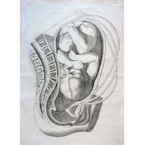 Charles Grignon (1717-1810) According to Jan Van Rymsdyk (1730-1788), VIEW OF THE UTERUS IN THE FIRST PHASE OF BIRTH.