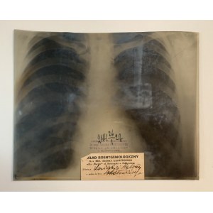 ZAKOPANE. WILLA MARILOR. ŁOZIŃSKA Halina - röntgen hrudníka [1927].