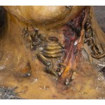 GAETANO GIULIO ZUMBO (Siracusa, 1656 - Paris, 1701), Anatomical bust with worms
