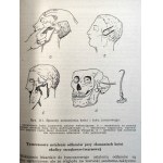 Entin D.A. - Vojenská maxilofaciálna chirurgia - Varšava 1953
