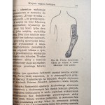 Kugler A. - Príprava pahýľov, protézy a konštrukcia umelých končatín - Varšava 1950