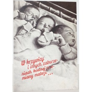 VIGANTOL krzywica dzieci [druk reklamowy farmacja apteka ca 1930]