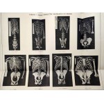 Loth E. - Antropomorfologja mięśni : problemat normalnej budowy człowieka - Lwów 1921 [ Ekslibris Muzeum Tatrzańskiego]