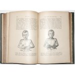 Kuhne L., NOWA METODA LECZENIA, 1894 (bez lekarstw i operacji) [ilustr., oprawa art.]