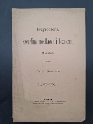 Dr. Heliodor Swiecicki Natural sternal and abdominal fissure (With figure) Year 1889