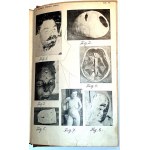 WACHHOLZ- MEDICINA GIUDIZIARIA, edito nel 1925.