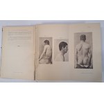 Archiv für klinische Chirurgie band 52 Berlin 1896 [CHIRURGIA]