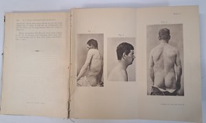 Archiv für klinische Chirurgie band 52 Berlin 1896 [CHIRURGY].