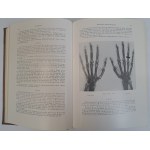 KIENBOCK Robert - Röntgendiagnostik der Knochen- und Gelenkkrankheiten II band 1-2 teil 1938 [MEDYCYNA]