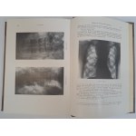 KIENBOCK Robert - Röntgendiagnostik der Knochen- und Gelenkkrankheiten II band 1-2 teil 1938 [MEDYCYNA]
