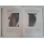 KIENBOCK Robert - Röntgendiagnostik der Knochen- und Gelenkkrankheiten II band 1-2 teil 1938 [MEDYCYNA]