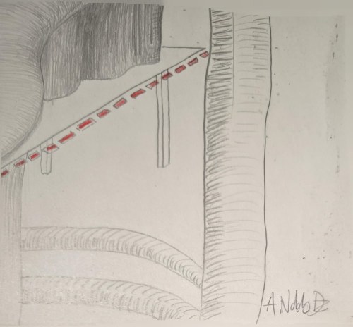 Andrzej Dziubek, pseud. Nebb (ur. 1954), Bez tytułu