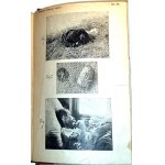WACHHOLZ-JUDICIAL MEDICINE publ. 1925