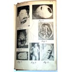 WACHHOLZ-JUDICIAL MEDICINE publ. 1925