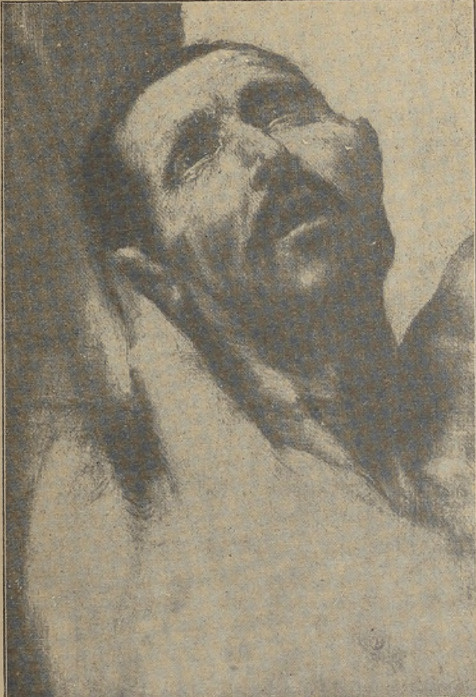 Fig. 7. Ribera. Męczeństwo Ś-go Bartłomieja. (Fragment). (Muzeum Prado. Madryt).