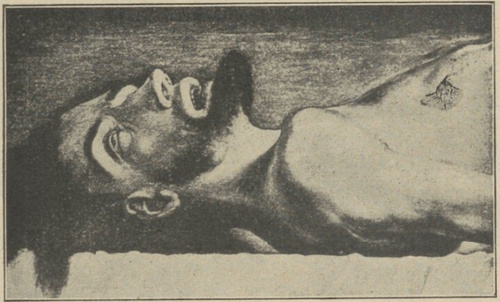 H. Holbein. Chrystus martwy. Fragment. Bazyleja
